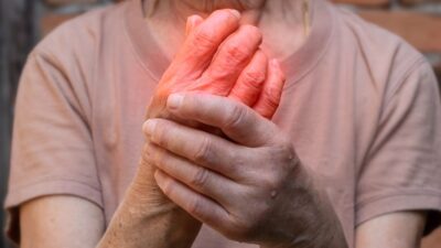 Artrite: sintomas, tipos comuns e tratamentos