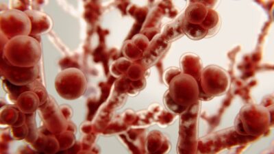 Candidíase: Sintomas, tratamento e prevenção