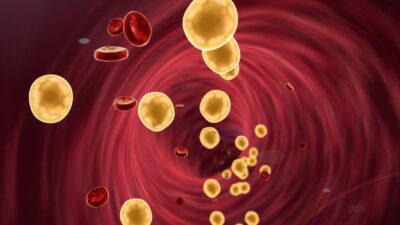 Colesterol alto: Como reduzir e prevenir problemas cardiovasculares