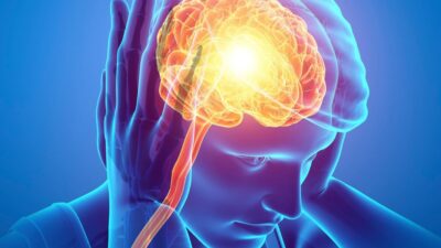 Enxaqueca: Sintomas, fatores e como aliviar as crises