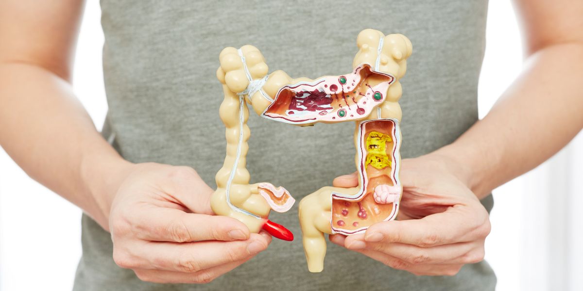 Prisão de ventre: Causas e 5 dicas para aliviar a constipação