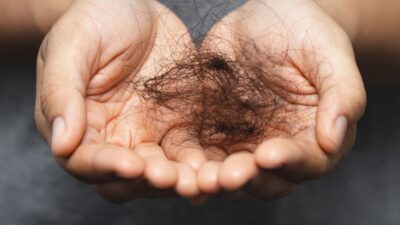 Queda de cabelo: Causas comuns e tratamentos para fortalecer os fios