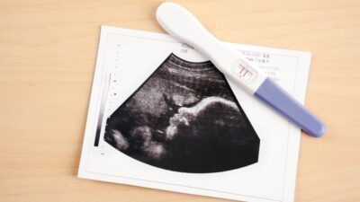 Sintomas de Gravidez: Conheça os 10 Primeiros Sinais e Quando Fazer o Teste